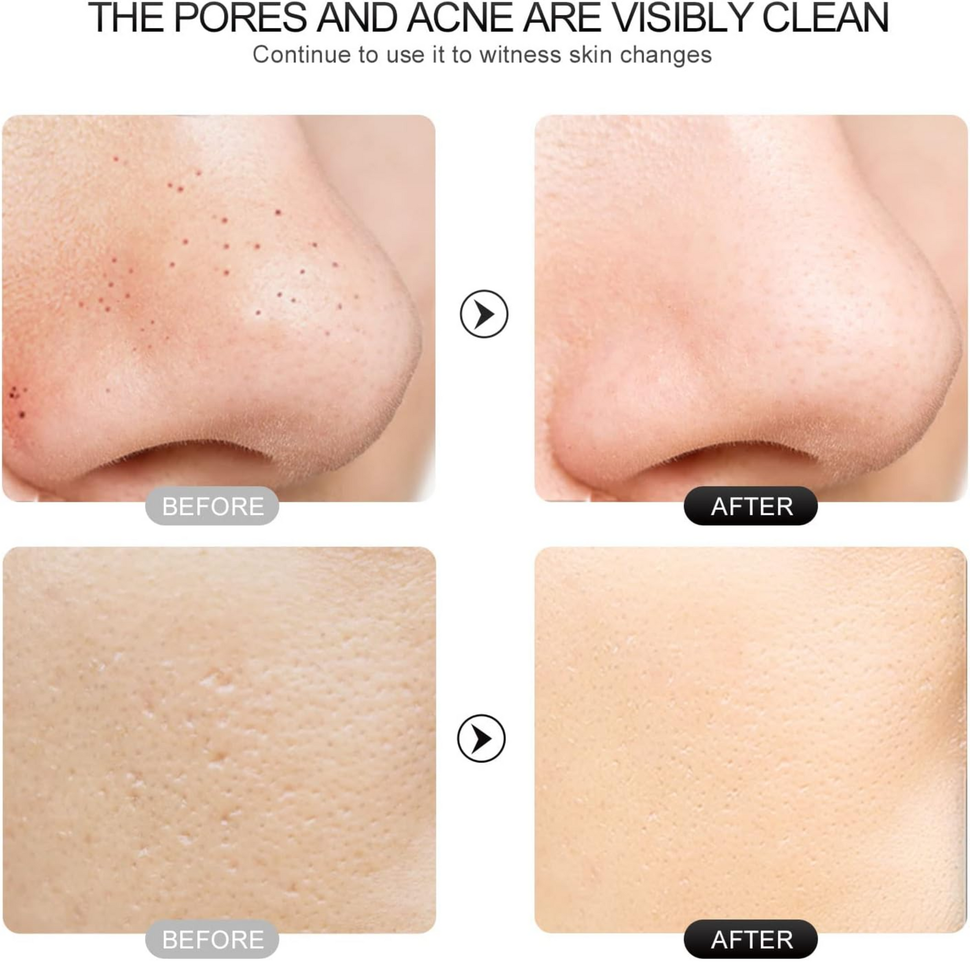 Espátula facial para exfoliar la piel